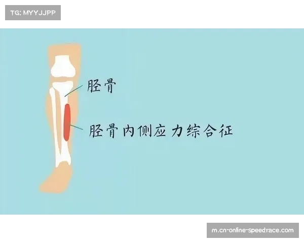 球员交易体检标准升级，防止隐性伤病风险